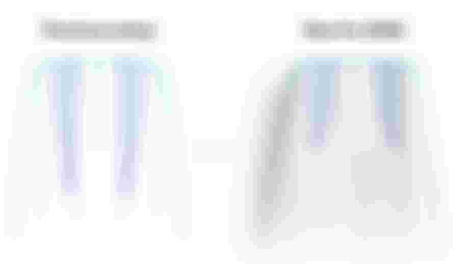 Bottom Channel Team Series